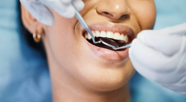 Best Emergency Tooth Extraction in Westport, WA