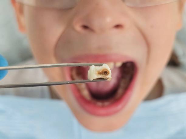 Best Emergency Denture Repair in Westport, WA